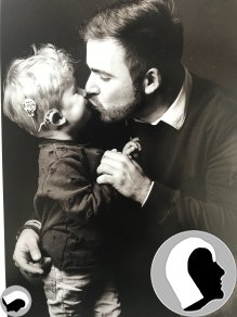 CI Kopf 2018 männlich Kind